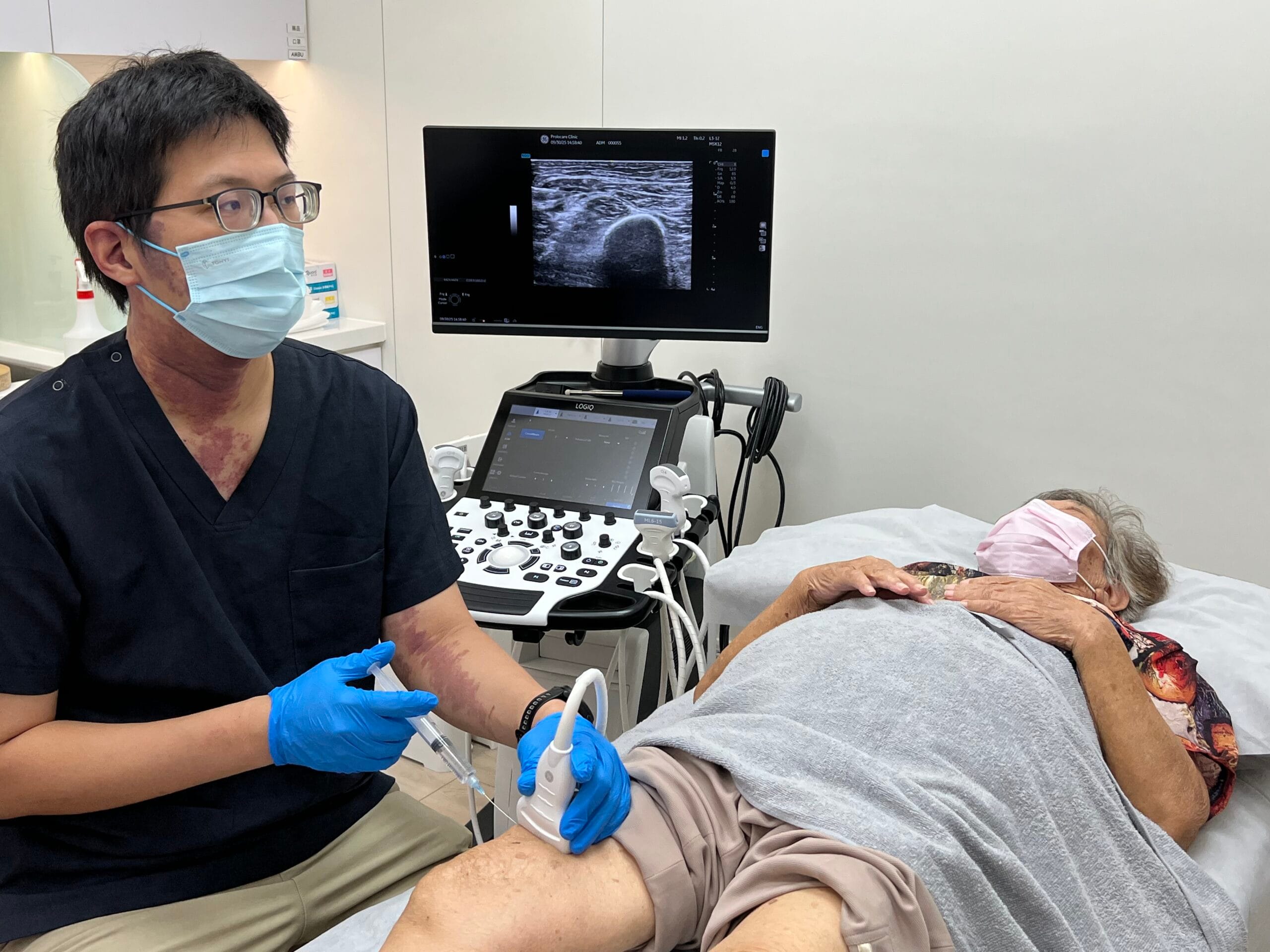 普羅診所廖偉成醫師以超音波導引進行膝關節處置,即時確認針尖位置與積液分布