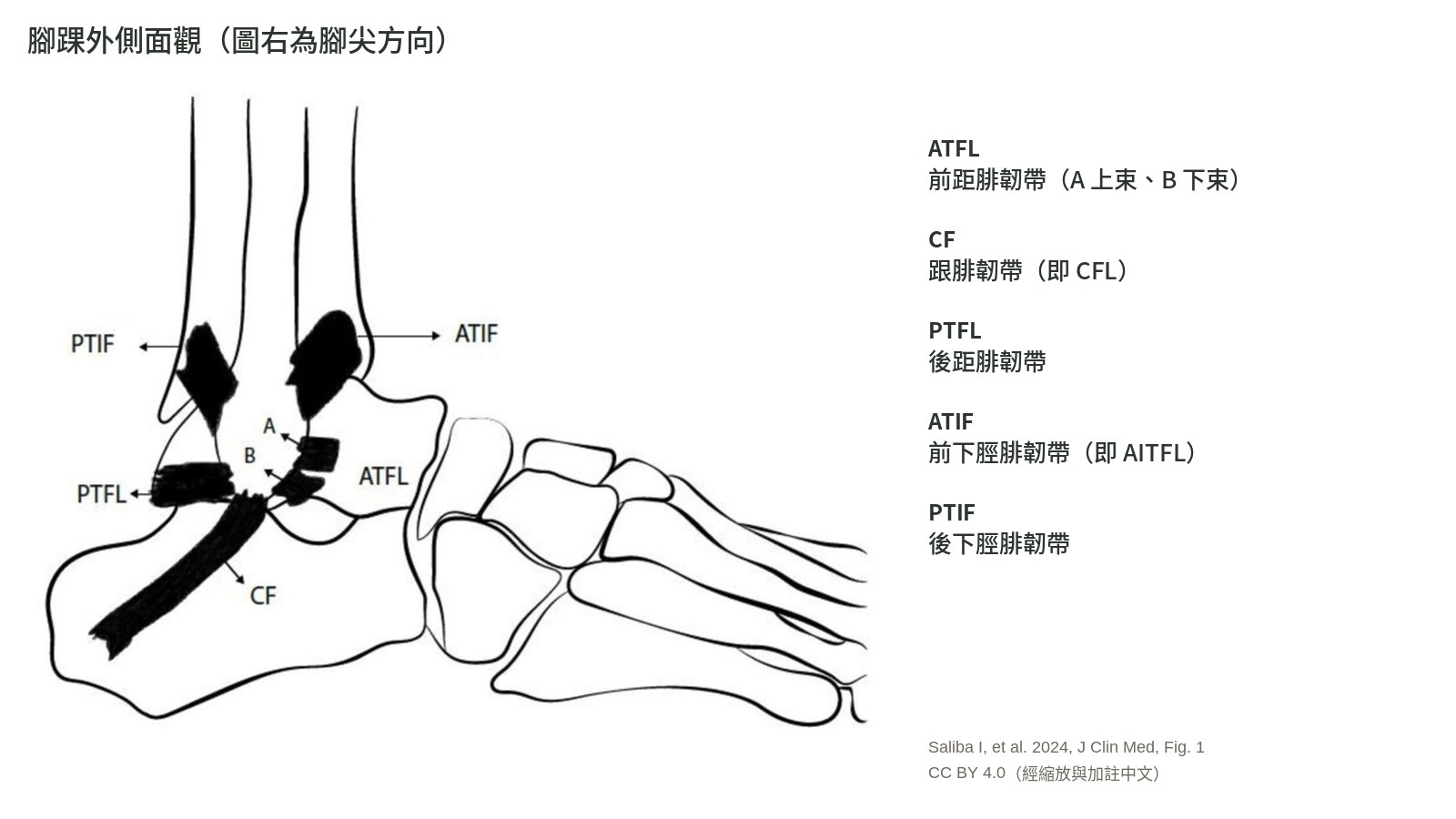 腳踝外側三條韌帶與骨頭的線條示意圖