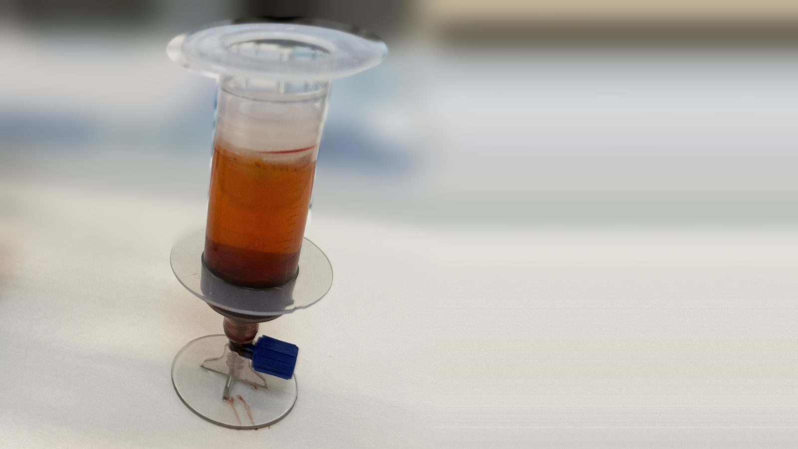 離心濃縮後的骨髓濃縮液製備管